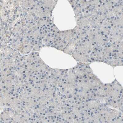 Immunohistochemistry-Paraffin: Lysine (K)-specific Demethylase 4A/KDM4A/JMJD2A Antibody [NBP1-87855]