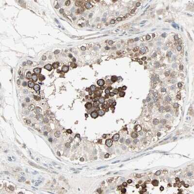 Immunohistochemistry-Paraffin: Lysine (K)-specific Demethylase 4A/KDM4A/JMJD2A Antibody [NBP1-87855]
