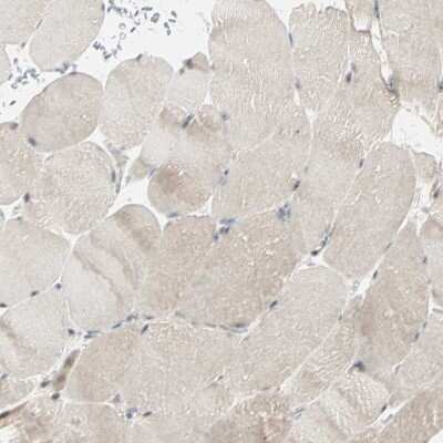 Immunohistochemistry-Paraffin: Lysine (K)-specific Demethylase 4A/KDM4A/JMJD2A Antibody [NBP1-87855]