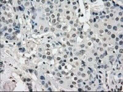 Immunohistochemistry: Lysine (K)-specific Demethylase 4C/KDM4C/JMJD2C Antibody (OTI5B9) - Azide and BSA Free [NBP2-72553]