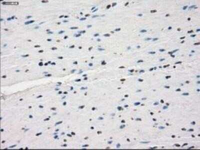 Immunohistochemistry: Lysine (K)-specific Demethylase 4C/KDM4C/JMJD2C Antibody (OTI5B9) - Azide and BSA Free [NBP2-72553]
