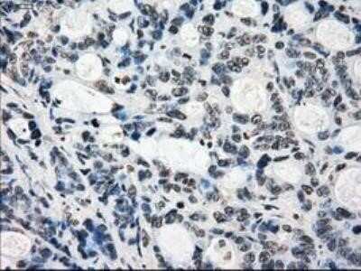Immunohistochemistry: Lysine (K)-specific Demethylase 4C/KDM4C/JMJD2C Antibody (OTI5B9) - Azide and BSA Free [NBP2-72553]