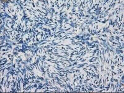 Immunohistochemistry: Lysine (K)-specific Demethylase 4C/KDM4C/JMJD2C Antibody (OTI5B9) - Azide and BSA Free [NBP2-72553]