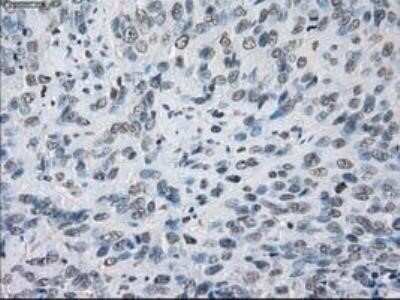 Immunohistochemistry: Lysine (K)-specific Demethylase 4C/KDM4C/JMJD2C Antibody (OTI5B9) - Azide and BSA Free [NBP2-72553]