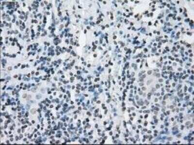 Immunohistochemistry: Lysine (K)-specific Demethylase 4C/KDM4C/JMJD2C Antibody (OTI5B9) - Azide and BSA Free [NBP2-72553]