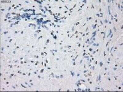 Immunohistochemistry: Lysine (K)-specific Demethylase 4C/KDM4C/JMJD2C Antibody (OTI5B9) - Azide and BSA Free [NBP2-72553]