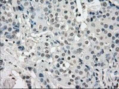 Immunohistochemistry-Paraffin: Lysine (K)-specific Demethylase 4C/KDM4C/JMJD2C Antibody (OTI5B9) [NBP1-47815]