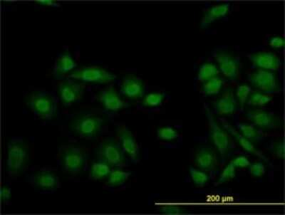 Immunocytochemistry/ Immunofluorescence: Lysine (K)-specific Demethylase 5B/KDM5B/JARID1B Antibody (1G10) [H00010765-M02]