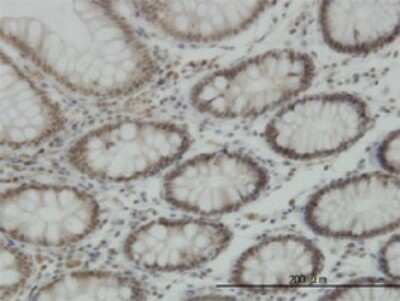 Immunohistochemistry-Paraffin: Lysine (K)-specific Demethylase 5B/KDM5B/JARID1B Antibody (1G10) [H00010765-M02]