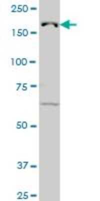 Western Blot: Lysine (K)-specific Demethylase 5B/KDM5B/JARID1B Antibody (1G10) [H00010765-M02]