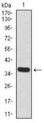 Western Blot: Lysine (K)-specific Demethylase 5B/KDM5B/JARID1B Antibody (7H3D7)BSA Free [NBP2-52500]