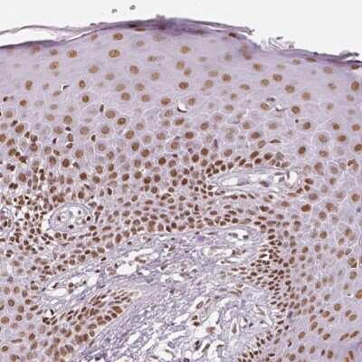 Immunohistochemistry-Paraffin: Lysine (K)-specific Demethylase 5B/KDM5B/JARID1B Antibody [NBP1-84352]