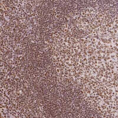 Immunohistochemistry-Paraffin: Lysine (K)-specific Demethylase 5B/KDM5B/JARID1B Antibody [NBP1-84352]