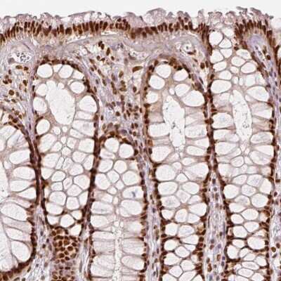 Immunohistochemistry-Paraffin: Lysine (K)-specific Demethylase 5B/KDM5B/JARID1B Antibody [NBP1-84352]