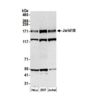 Western Blot: Lysine (K)-specific Demethylase 5B/KDM5B/JARID1B Antibody [NB100-97821]