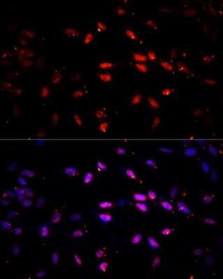 Immunocytochemistry/ Immunofluorescence: Lysine (K)-specific Demethylase 6B/KDM6B/JMJD3 Antibody - Azide and BSA Free [NBP2-92982]