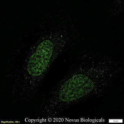 Immunocytochemistry/ Immunofluorescence: Lysine (K)-specific Demethylase 6B/KDM6B/JMJD3 Antibody - BSA Free [NBP3-06855]