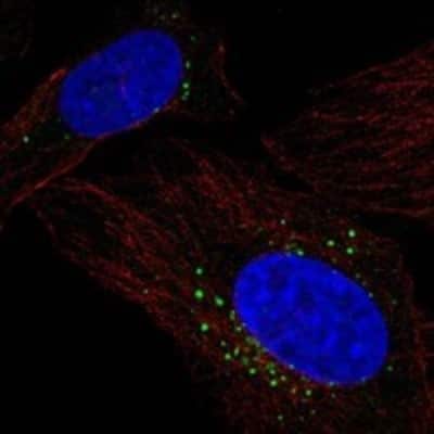 Immunocytochemistry/ Immunofluorescence: Lysosomal Pro-X Carboxypeptidase/PRCP Antibody [NBP3-17883]