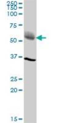 Western Blot: Lysosomal Pro-X Carboxypeptidase/PRCP Antibody [H00005547-B01P]