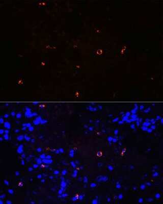 Immunocytochemistry/ Immunofluorescence: Lysozyme Antibody (9B2O6) [NBP3-15290]