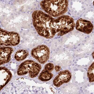 Immunohistochemistry-Paraffin: Lysozyme Antibody [NBP2-33518]