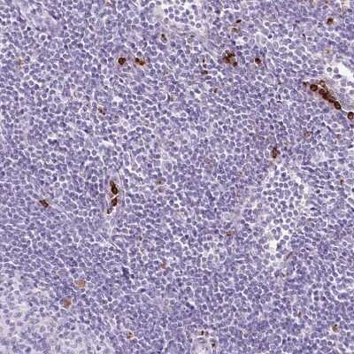 Immunohistochemistry-Paraffin: Lysozyme Antibody [NBP2-33518]