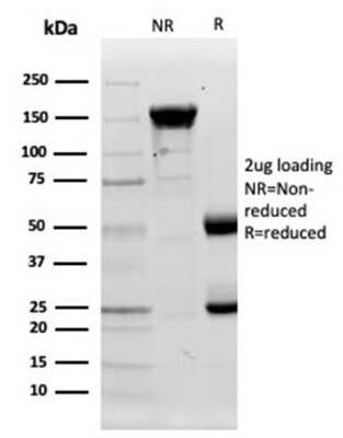 Protein Array: Lysozyme Antibody (LYZ/3944) - Azide and BSA Free [NBP3-14115]