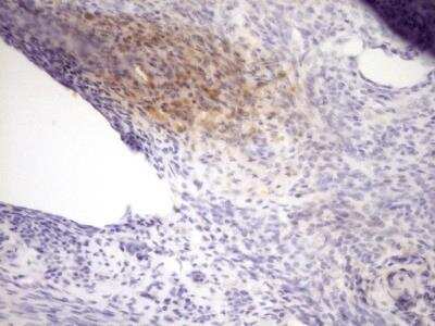 Immunohistochemistry-Paraffin: Lysyl Oxidase Homolog 2/LOXL2 Antibody (OTI8B2) [NBP2-45669]
