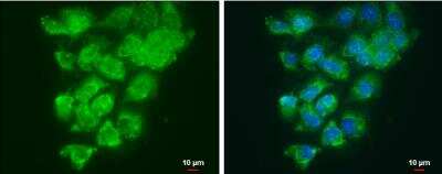Immunocytochemistry/ Immunofluorescence: Lysyl Oxidase Homolog 2/LOXL2 Antibody [NBP1-32954]