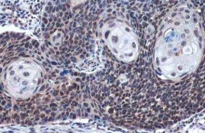 Immunohistochemistry-Paraffin: Lysyl Oxidase Homolog 2/LOXL2 Antibody [NBP1-32954]