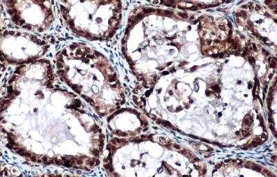 Immunohistochemistry-Paraffin: Lysyl Oxidase Homolog 2/LOXL2 Antibody [NBP1-32954]