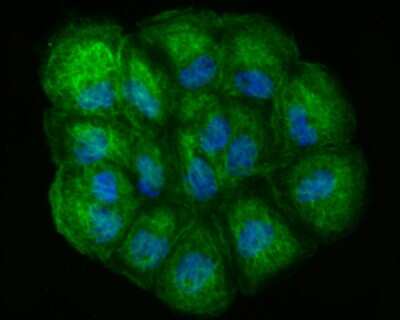 Immunocytochemistry/ Immunofluorescence: Lysyl Oxidase Homolog 2/LOXL2 Antibody (JU32-53) [NBP2-75559]