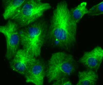 Immunocytochemistry/ Immunofluorescence: Lysyl Oxidase Homolog 2/LOXL2 Antibody (JU32-53) [NBP2-75559]