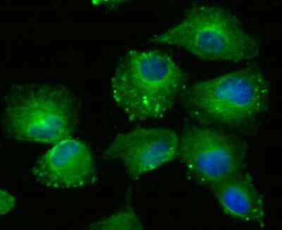 Immunocytochemistry/ Immunofluorescence: Lysyl Oxidase Homolog 2/LOXL2 Antibody (JU32-53) [NBP2-75559]