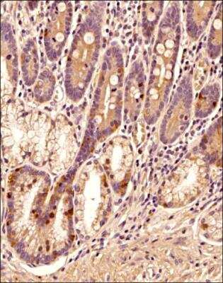 Immunohistochemistry-Paraffin: Lysyl Oxidase Homolog 3/LOXL3 Antibody - BSA Free [NBP2-75964]