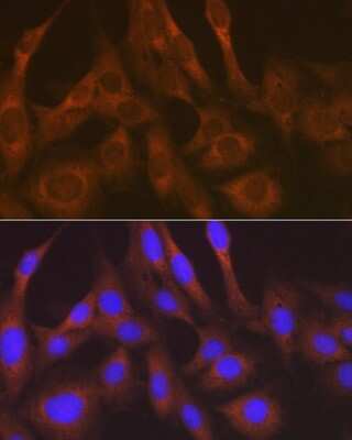 Immunocytochemistry/ Immunofluorescence: Lysyl tRNA synthetase Antibody (2V2B6) [NBP3-16670]