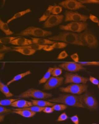 Immunocytochemistry/ Immunofluorescence: Lysyl tRNA synthetase Antibody (2V2B6) [NBP3-16670]