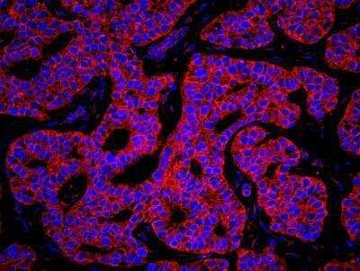Immunocytochemistry/ Immunofluorescence: Lysyl tRNA synthetase Antibody [NB100-1719]