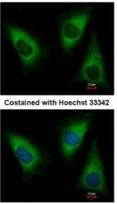 Immunocytochemistry/ Immunofluorescence: Lysyl tRNA synthetase Antibody [NBP1-32063]