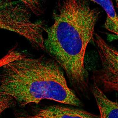 Immunocytochemistry/ Immunofluorescence: Lysyl tRNA synthetase Antibody [NBP1-87706]