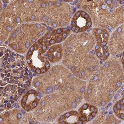 Immunohistochemistry-Paraffin: Lysyl tRNA synthetase Antibody [NBP1-87705]