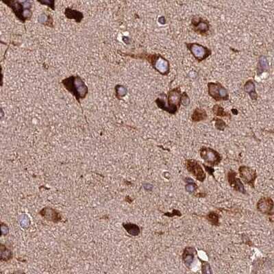 Immunohistochemistry-Paraffin: Lysyl tRNA synthetase Antibody [NBP1-87705]