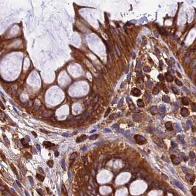 Immunohistochemistry-Paraffin: Lysyl tRNA synthetase Antibody [NBP1-87705]