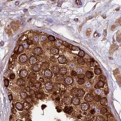Immunohistochemistry-Paraffin: Lysyl tRNA synthetase Antibody [NBP1-87705]