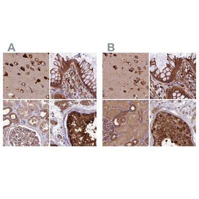 Immunohistochemistry-Paraffin: Lysyl tRNA synthetase Antibody [NBP1-87706]