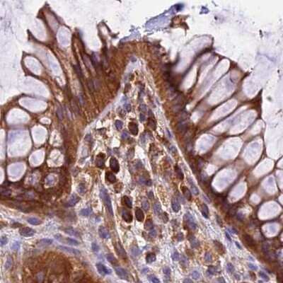 Immunohistochemistry-Paraffin: Lysyl tRNA synthetase Antibody [NBP1-87706]