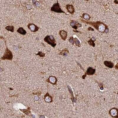 Immunohistochemistry-Paraffin: Lysyl tRNA synthetase Antibody [NBP1-87706]