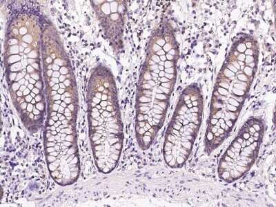 Immunohistochemistry-Paraffin: Lysyl tRNA synthetase Antibody [NBP2-99362]