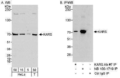 Western Blot: Lysyl tRNA synthetase Antibody [NB100-1719]