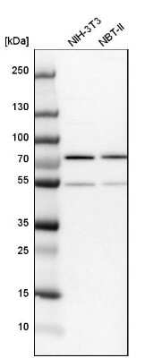 Western Blot: Lysyl tRNA synthetase Antibody [NBP1-87705]